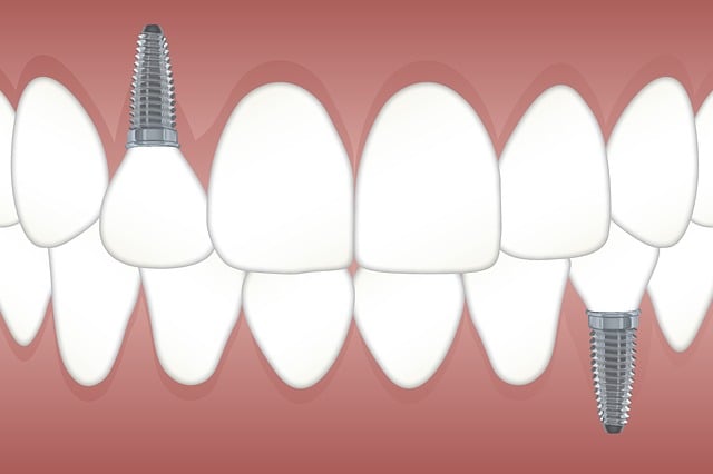 3D-Implantologie: Präzision trifft Innovation